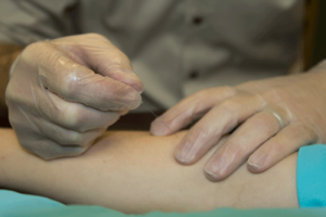 triggerpointdryneedlingcourse